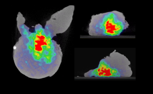 Prostate specimen PET-CT imaging in the spotlight at EAU 2023