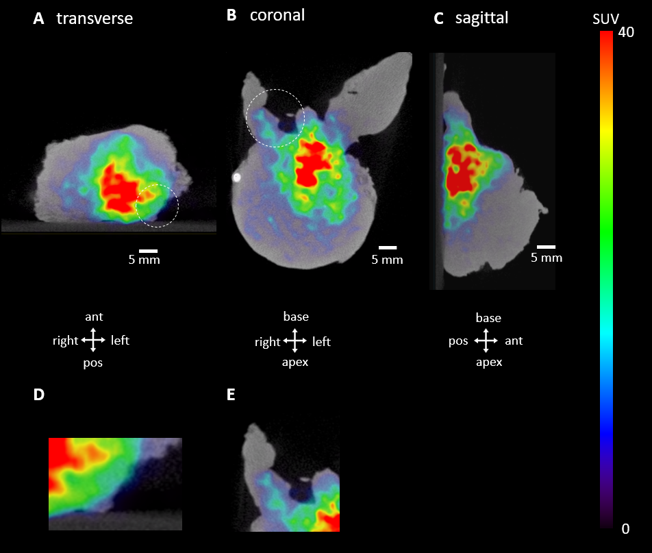 PET-CT specimen images