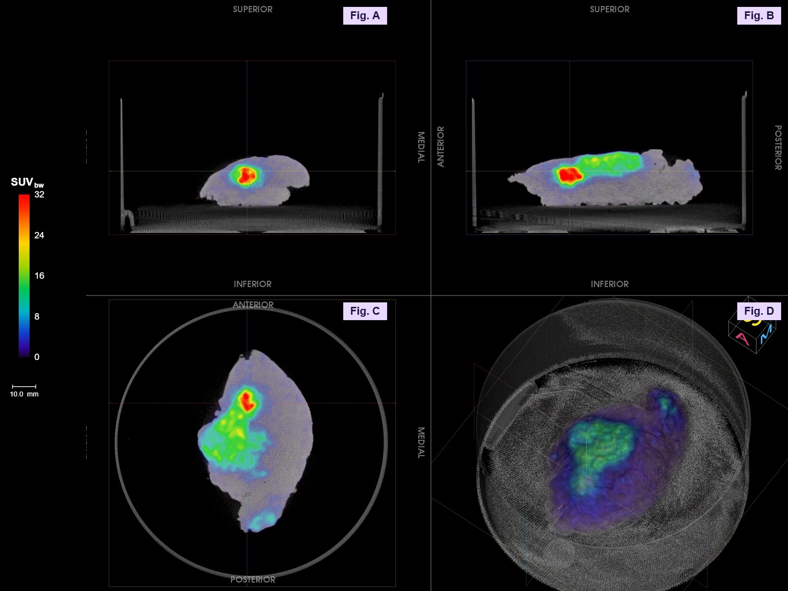 Specimen PET-CT images