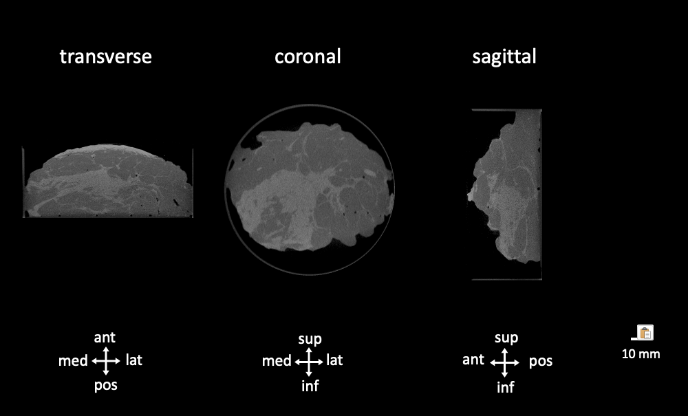 PET-CT specimen images