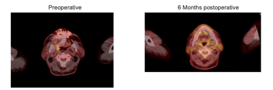 Histopathological Evaluation
