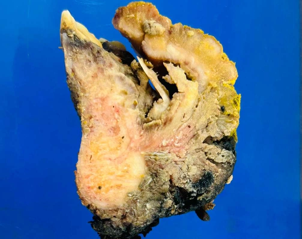 Histopathological Evaluation 