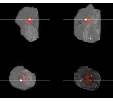 Extend your PET-CT imaging services to the OR