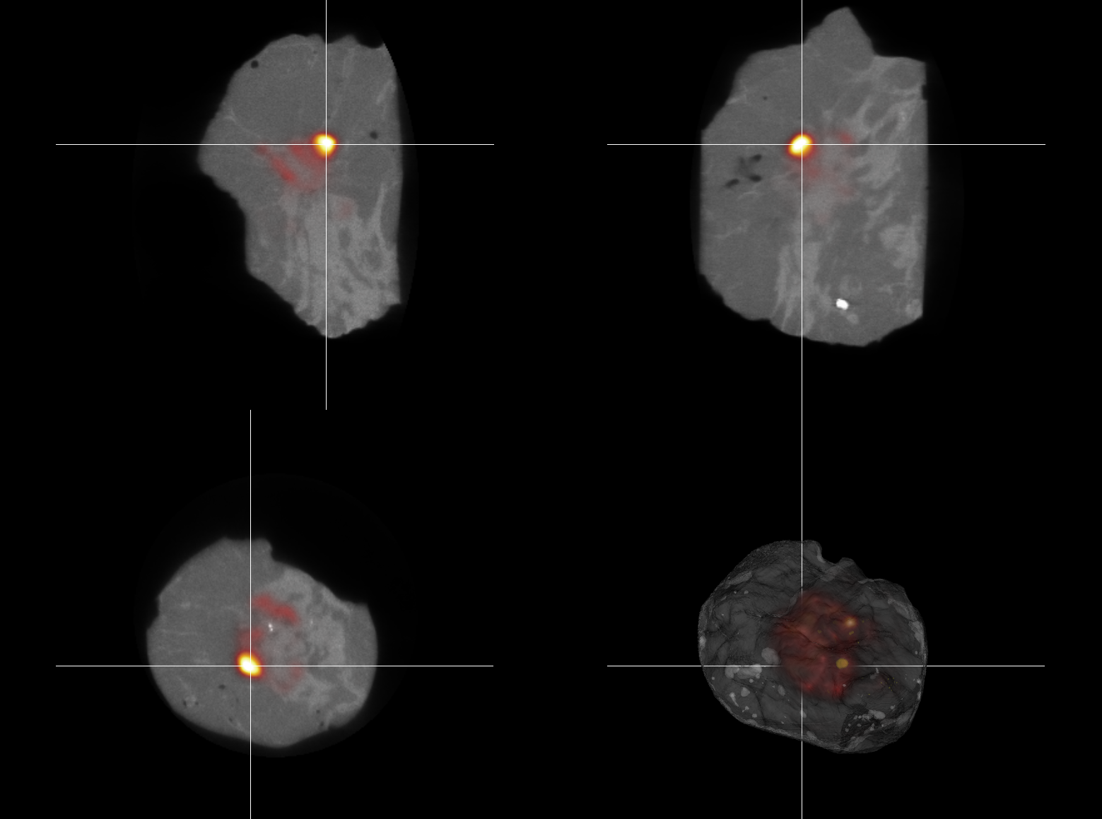 Powerful medical imaging processing